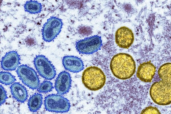 DRC_Declares_Mpox_Outbreak_a_Continental_Emergency_with_Over_570_Deaths