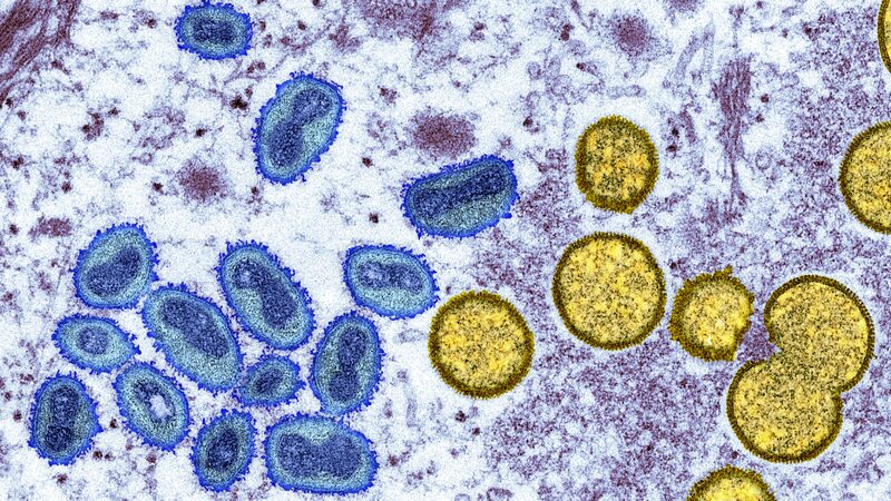DRC_Declares_Mpox_Outbreak_a_Continental_Emergency_with_Over_570_Deaths
