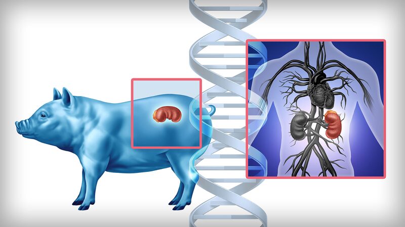 Pioneering_Pig_to_Human_Kidney_Transplant_Sparks_Global_Hope