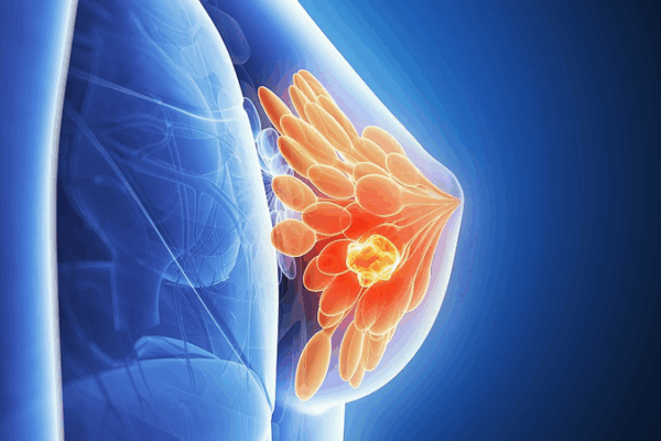 How Breast Cancer Hibernates: New Insights Could Lead to Lasting Therapies How_Breast_Cancer_Hibernates__New_Insights_Could_Lead_to_Lasting_Therapies