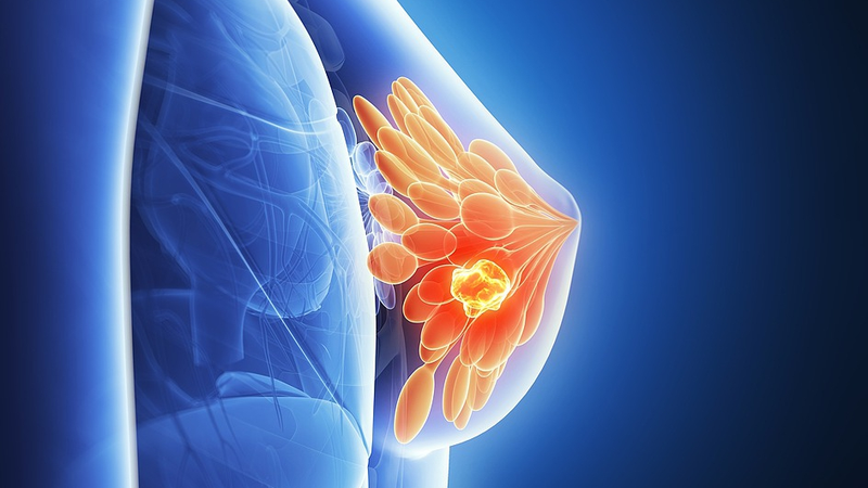How_Breast_Cancer_Hibernates__New_Insights_Could_Lead_to_Lasting_Therapies - My Global News: Voices of a New Era How_Breast_Cancer_Hibernates__New_Insights_Could_Lead_to_Lasting_Therapies