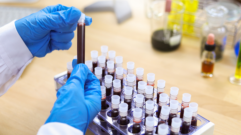 New_Gene_Therapy_Redefines_Hemophilia_B_Treatment - My Global News: Voices of a New Era New_Gene_Therapy_Redefines_Hemophilia_B_Treatment