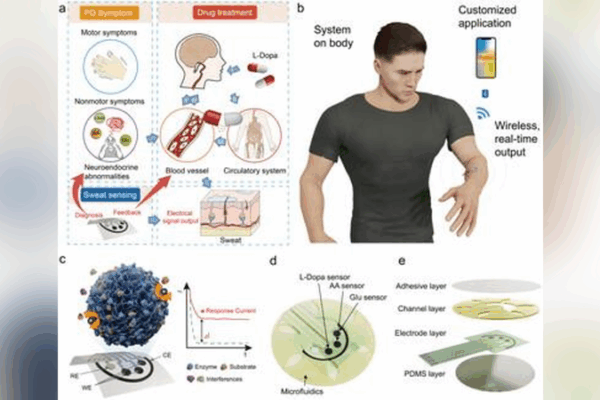 New Sweat Sensor Patch Offers Early Parkinson’s Alerts New Sweat Sensor Patch Offers Early Parkinson’s Alerts