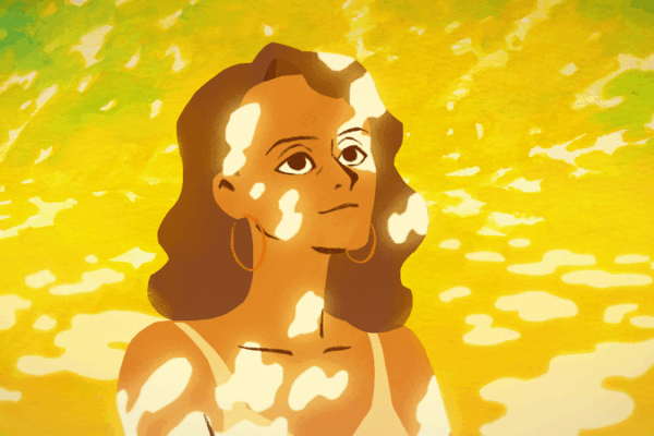 Spots and Strength: Animator Li Jiahao’s Journey with Vitiligo Spots_and_Strength__Animator_Li_Jiahao_s_Journey_with_Vitiligo