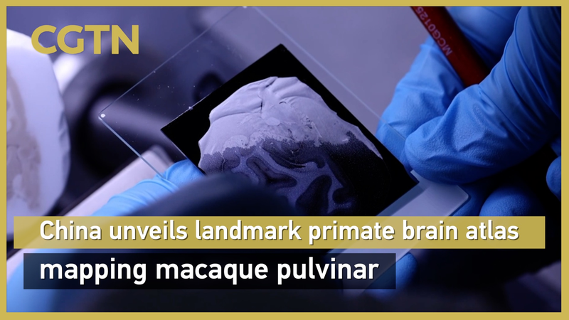 Chinese mainland-led Team Unveils Landmark Macaque Pulvinar Brain Atlas Chinese_mainland_led_Team_Unveils_Landmark_Macaque_Pulvinar_Brain_Atlas video poster