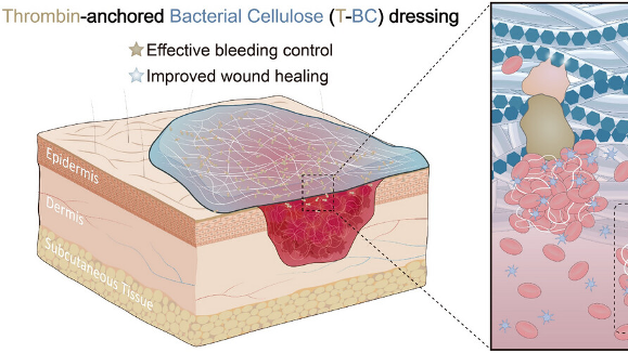 New Bacterial Cellulose Dressing Stops Burn Bleeds in 60 Seconds New_Bacterial_Cellulose_Dressing_Stops_Burn_Bleeds_in_60_Seconds