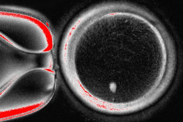 Scientists Generate Functional Eggs from Skin Cells in Lab Breakthrough Scientists_Generate_Functional_Eggs_from_Skin_Cells_in_Lab_Breakthrough